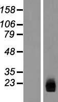 ZNHIT3 Human Over-expression Lysates NM_004773