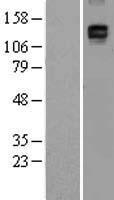 CD163 Human Over-expression Lysates NM_004244