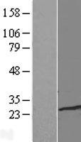 TCEAL1 Human Over-expression Lysates NM_001006639