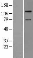 TAOK2 Human Over-expression Lysates NM_004783