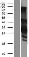 CER1 Human Over-expression Lysates NM_005454