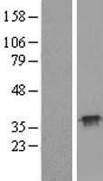 TXNL1 Human Over-expression Lysates NM_004786