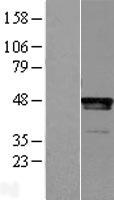 LHX2 Human Over-expression Lysates NM_004789