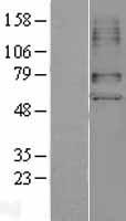 ls009356 slc22a6 human over expression lysates nm 004790 wb testing 1