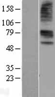 ls009356 slc22a6 human over expression lysates nm 153276 wb testing 2