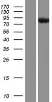 PPIG Human Over-expression Lysates NM_004792