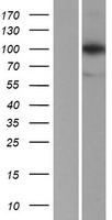 LONP1 Human Over-expression Lysates NM_004793