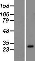 RAB33A Human Over-expression Lysates NM_004794