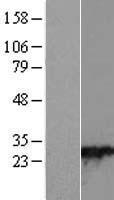 ls009364 rab28 human over expression lysates nm 001017979 wb testing 1
