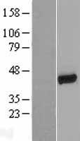 EBP50 (SLC9A3R1) Human Over-expression Lysates NM_004252