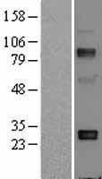 Adiponectin (ADIPOQ) Human Over-expression Lysates NM_004797
