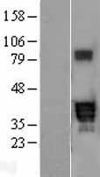 ls009374 ppt2 human over expression lysates nm 005155 wb testing 1