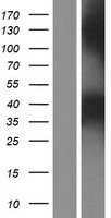 ls009374 ppt2 human over expression lysates nm 138717 wb testing 2