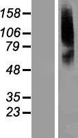 SLC22A8 Human Over-expression Lysates NM_004254