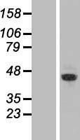 ZRANB2 Human Over-expression Lysates NM_005455