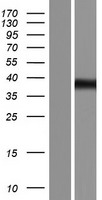 ZRANB2 Human Over-expression Lysates NM_203350
