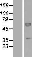 PEX16 Human Over-expression Lysates NM_057174