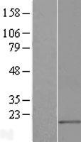 Surb7 (MED21) Human Over-expression Lysates NM_004264