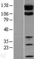 ls009414 tjp2 human over expression lysates nm 004817 wb testing 1