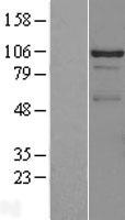 DDX23 Human Over-expression Lysates NM_004818