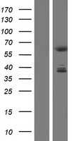 CDYL Human Over-expression Lysates NM_170751
