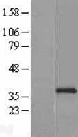 NCR1 Human Over-expression Lysates NM_004829