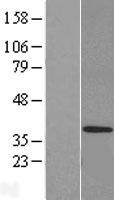 CRSP8 (MED27) Human Over-expression Lysates NM_004269