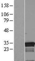 ls009443 crsp9 med7 human over expression lysates nm 004270 wb testing 2