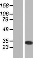 ls009446 glutathione s transferase omega 1 gsto1 human over expression lysates nm 004832 wb testing 2