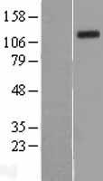 PERK (EIF2AK3) Human Over-expression Lysates NM_004836