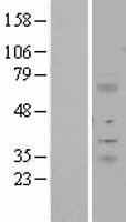 ITM2A Human Over-expression Lysates NM_004867