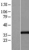GGPS1 Human Over-expression Lysates NM_001037277
