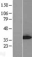 GGPS1 Human Over-expression Lysates NM_004837