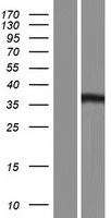 ls009454 homer3 human over expression lysates nm 001145724 wb testing 4
