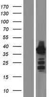 HOMER2 Human Over-expression Lysates NM_199331