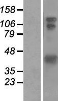 HOMER1 Human Over-expression Lysates NM_004272