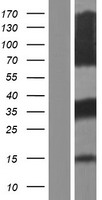 ACT (FHL5) Human Over-expression Lysates NM_001170807