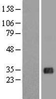 ACT (FHL5) Human Over-expression Lysates NM_020482
