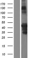 PICK1 Human Over-expression Lysates NM_001039584
