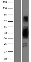 AKAP7 Human Over-expression Lysates NM_016377