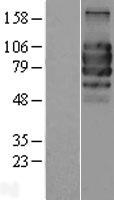 TCCR (IL27RA) Human Over-expression Lysates NM_004843
