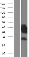 ls009467 sh3bp5 human over expression lysates nm 001018009 wb testing 2