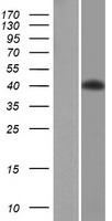 ls009468 pcyt1b human over expression lysates nm 004845 wb testing 1