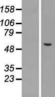ls009469 chst3 human over expression lysates nm 004273 wb testing 1