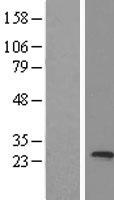 trfp (MED20) Human Over-expression Lysates NM_004275