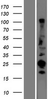 CABP (CABP1) Human Over-expression Lysates NM_031205