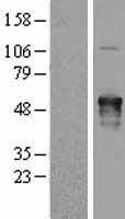 ls009495 akap5 human over expression lysates nm 004857 wb testing 1