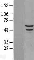 Myotilin (MYOT) Human Over-expression Lysates NM_006790
