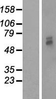 ls009512 pmpcb human over expression lysates nm 004279 wb testing 1