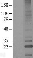 LITAF Human Over-expression Lysates NM_001136472